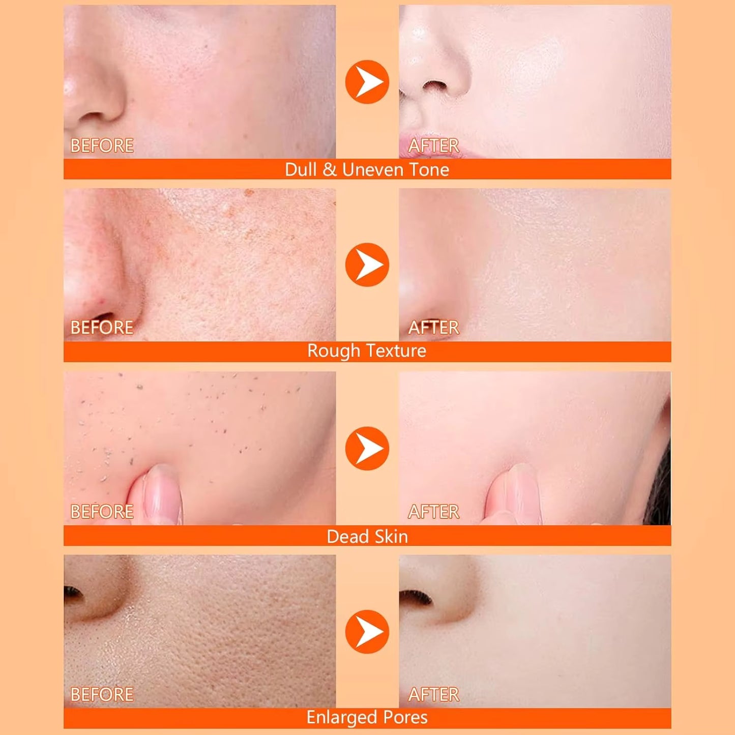 Peel Shot - Kojic + Turmeric Body Peel Spray